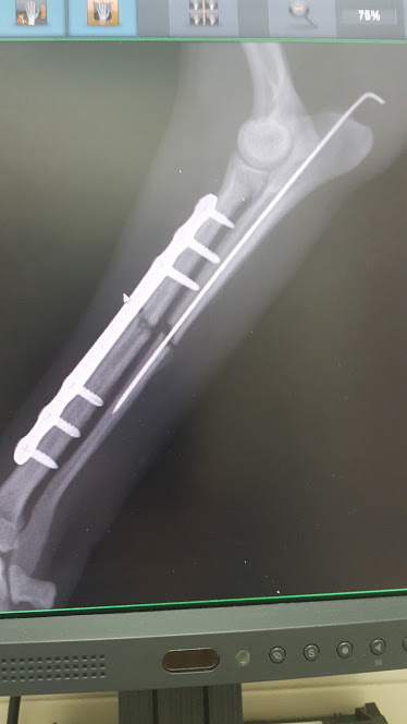 intervento ginocchio