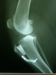 ortopedia ginocchio.jpg